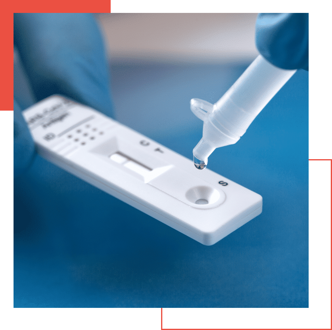  A gloved hand holds a pipette, carefully placing a drop of liquid onto a COVID-19 rapid test cassette on a blue surface. This meticulous procedure is crucial for monitoring MDR variants effectively.